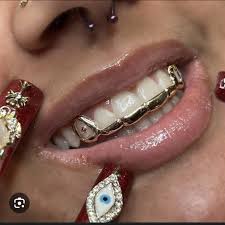 Custom Gold Grillz